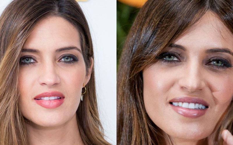 famosos dientes antes y después 0 5